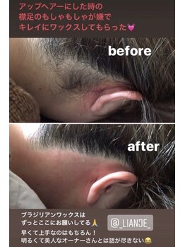 リアンジェ(Lianje)/うなじWax脱毛　お客様の掲載