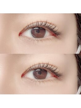 フーフロー(Fooflow)/フラットラッシュ100本