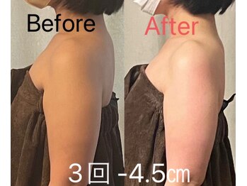 キートス(Kiitos)/