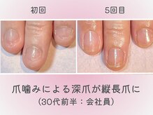ココデネイル(cocode nail)