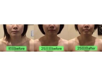 アジール 長岡リバーサイド千秋店(agir)/before/after画像