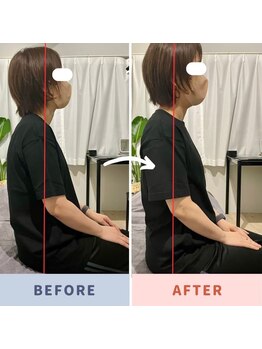 マクシル 札幌店 puls1(MAXIL)/とにかく頭痛がヒドい