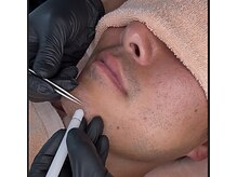 ペンナヌウク(penna nuuc)/その毛に終止符を。