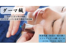 フラット柏(FLAT柏)/【美容鍼】ダーマ鍼で毛穴ケア