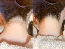 ライトウェーブ 松本村井本店/美しすぎる、えり足脱毛