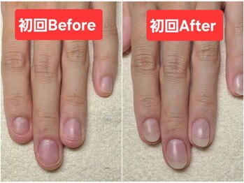 マニブルーム/長さ出しBefore&After右手