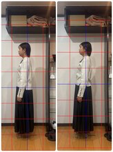 カケル鍼灸整体院(KAKERU鍼灸整体院)/