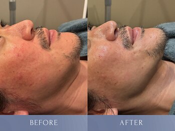 カズキ ハギワラ(Kazuki Hagiwara)/クリスティーナ当日ビフォアフ