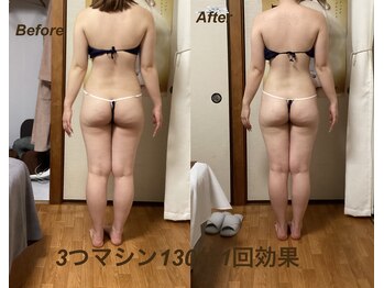 ミュー 新小岩店(Mieux)/3つマシン1回効果