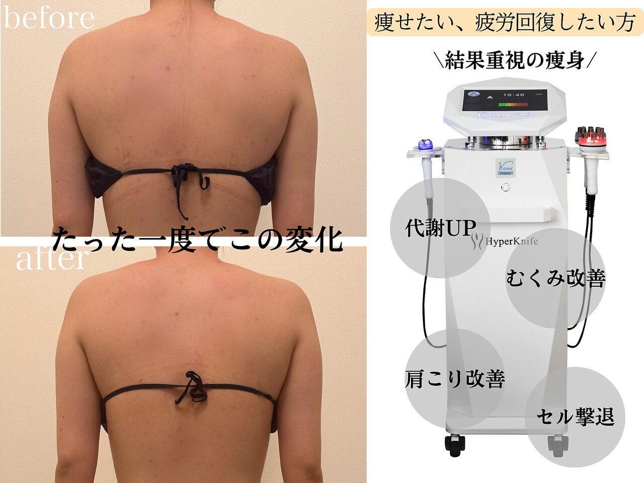 23ビューティー(23beauty)｜ホットペッパービューティー