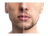 【MENS】ひげ脱毛(お顔全体)　リピーター様のみ受付