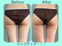 ビーナイス ビューティー(Be Nice Beauty)/ヒップ横張りNG！