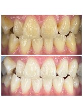 エンムスビ(enmusubi)/