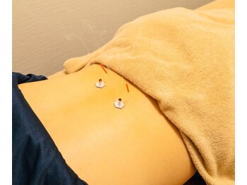 ナイン整骨院 三軒茶屋院の写真/【初めて鍼灸を受ける方も安心】丁寧なカウンセリング＆高技術でお悩み改善!初回限定[鍼灸コース]¥5,900
