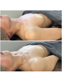 モア(moa)/50代のバストもふっくら