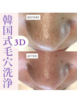 モーヴ 藤沢(MAUVE)/施術風景