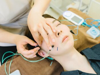 ハリファ鍼灸院 福岡博多院(HariFa鍼灸院)/リフトアップ美容鍼