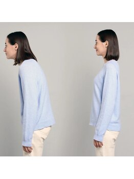 ヒューマン鍼灸接骨院/猫背や悪い姿勢は