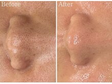 サロン ド ベル(Salon de Belle)/ララピール　施術後