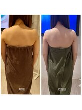 アピロスビアンティ(APEIROS BIANTY)/【ブライダル痩身】花嫁ケア