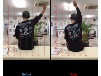 ストレチックス 近江八幡店/BeforeAfter