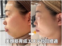 リエル(RIEL)/小顔矯正×美顔筋育成エステ