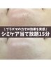 【シミ改善クイック】シミケア当て(15分)or導入+プラズマ+ヘッド ¥9350