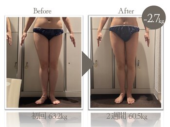 ビューティーリバース 戸塚店/★劇的ビフォーアフター★