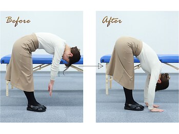 初台メディカルラボ整体院/【ビフォーアフター(1)】