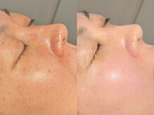 ルーナジェーナ(Luna llena)/池袋　エステ　ルーナジェーナ