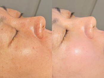 ルーナジェーナ(Luna llena)/池袋　エステ　ルーナジェーナ