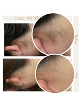 モアトゥインクル 福山宮通り店(MORE twinkle)/施術ルーム