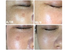 ユヌ(une)/光フォト　￥15000