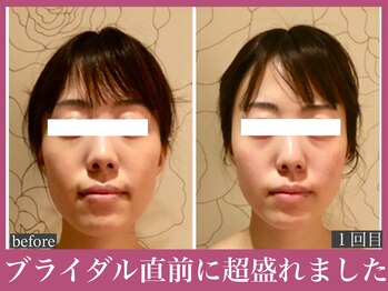 アクアビー(AQUA-B)/