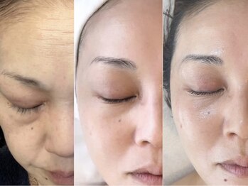 サロン エデンプラス(salon eden PLUS)/お肌が変わると自然と笑顔に♪