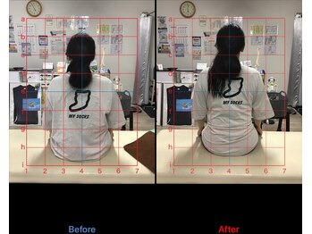 ストレチックス 近江八幡店/肩こり改善ビフォーアフター1回