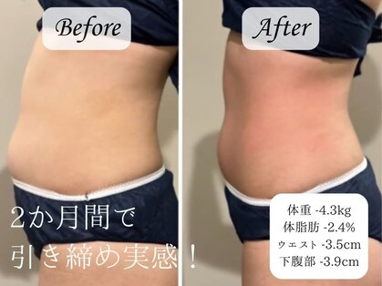 アヤエステティックサロン 綱島店(AYA)の写真