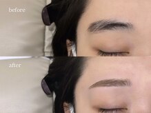 レーヴラグゼ(REVE LUXE)/before/after