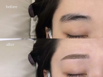 レーヴラグゼ(REVE LUXE)/before/after