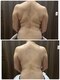 ミーラブ 鹿児島(miilove)の写真/40代からのウキウキ変化♪たった2回で背中がすっきり！！ボディーラインを整えながら身体の軽さも◎