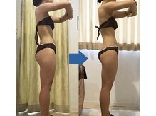 ピュアトゥルー 岐阜西店(PureTrue)/余分なお肉に高周波！ラジオ派！