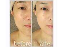 アン グレーヌ 自由が丘(unegraine)/キリっと美しい瞳♪