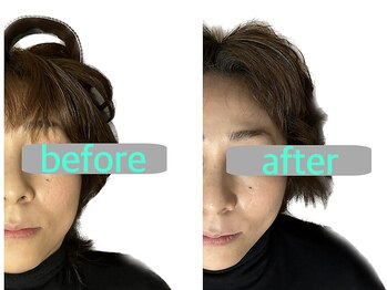 ゼン整体(ZEN)/小顔矯正ビフォーアフター