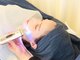 モアビューティー 庚午店(MORE BEAUTY)の写真/つるんとハリのあるお肌へと導く♪NEW★エクソソーム無針水光導入【シミ改善・たるみケア】お試し¥8250!!