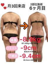 アフリオーラ はなみずき店(affriolant)/ビフォーアフター