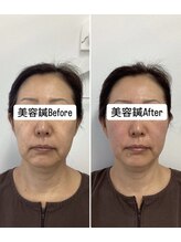 ハリサロンドオフ 堺東店(hari salon de off)/お客様before→after