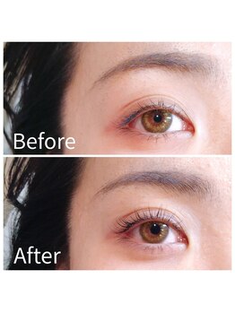 トーナイ アティル(TONAI atil)/