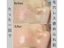 ブラックボックス(BLACK BOX)/那珂市30代のお客様