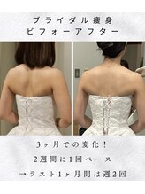 アシュレ リル(assure Lilou)/【ブライダル】Before→After