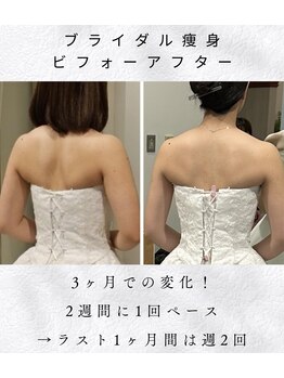 アシュレ リル(assure Lilou)/【ブライダル】Before→After
